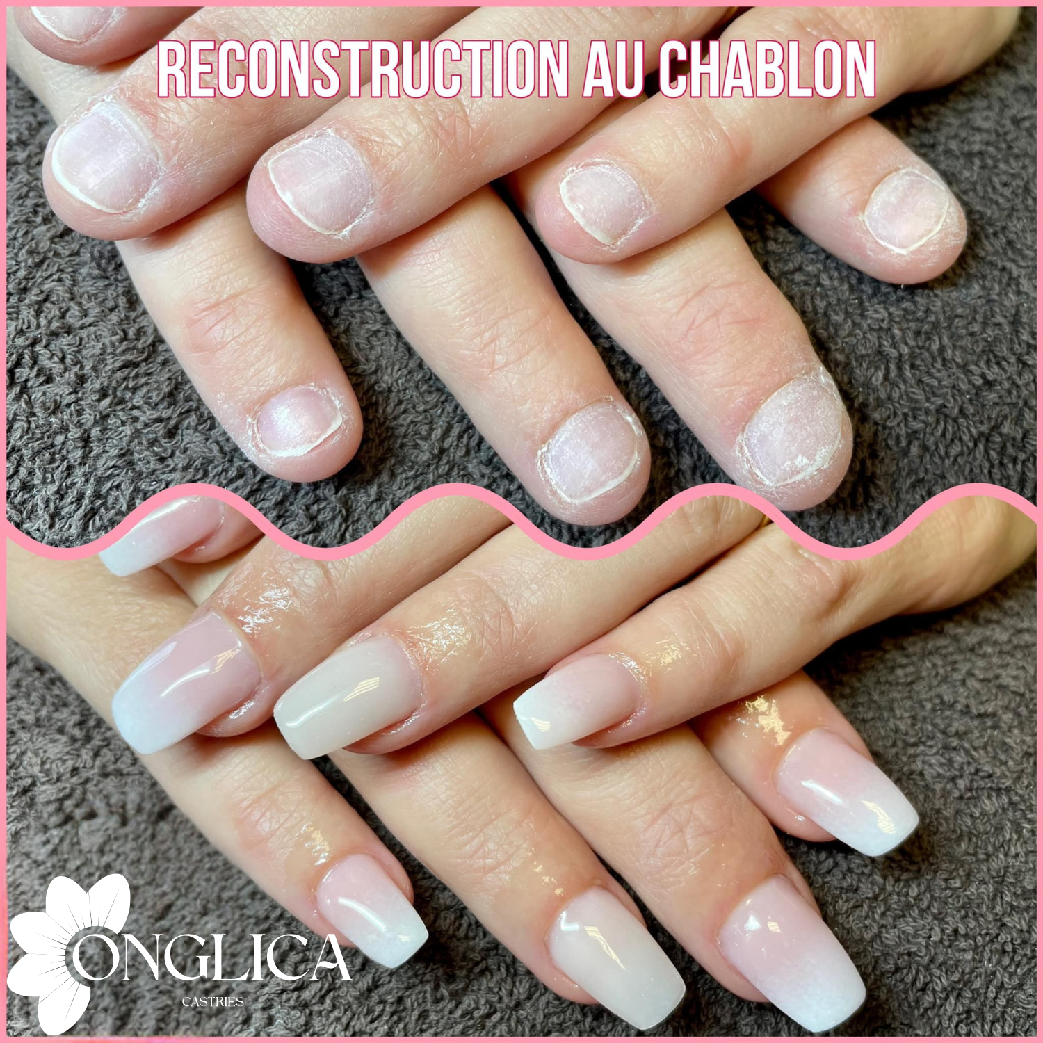 Extension Chablon 1